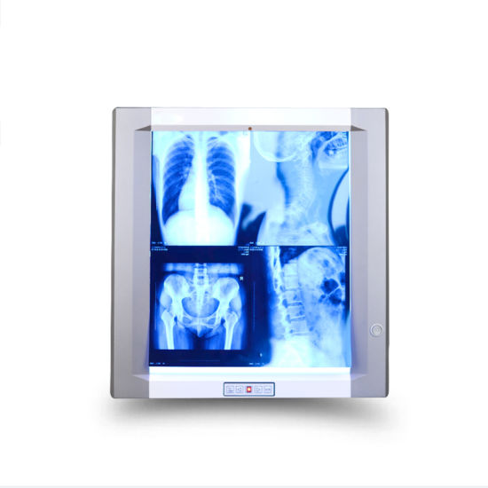 Medical-X-ray-Luxurious-Observation-Lamp-Film-Viewer